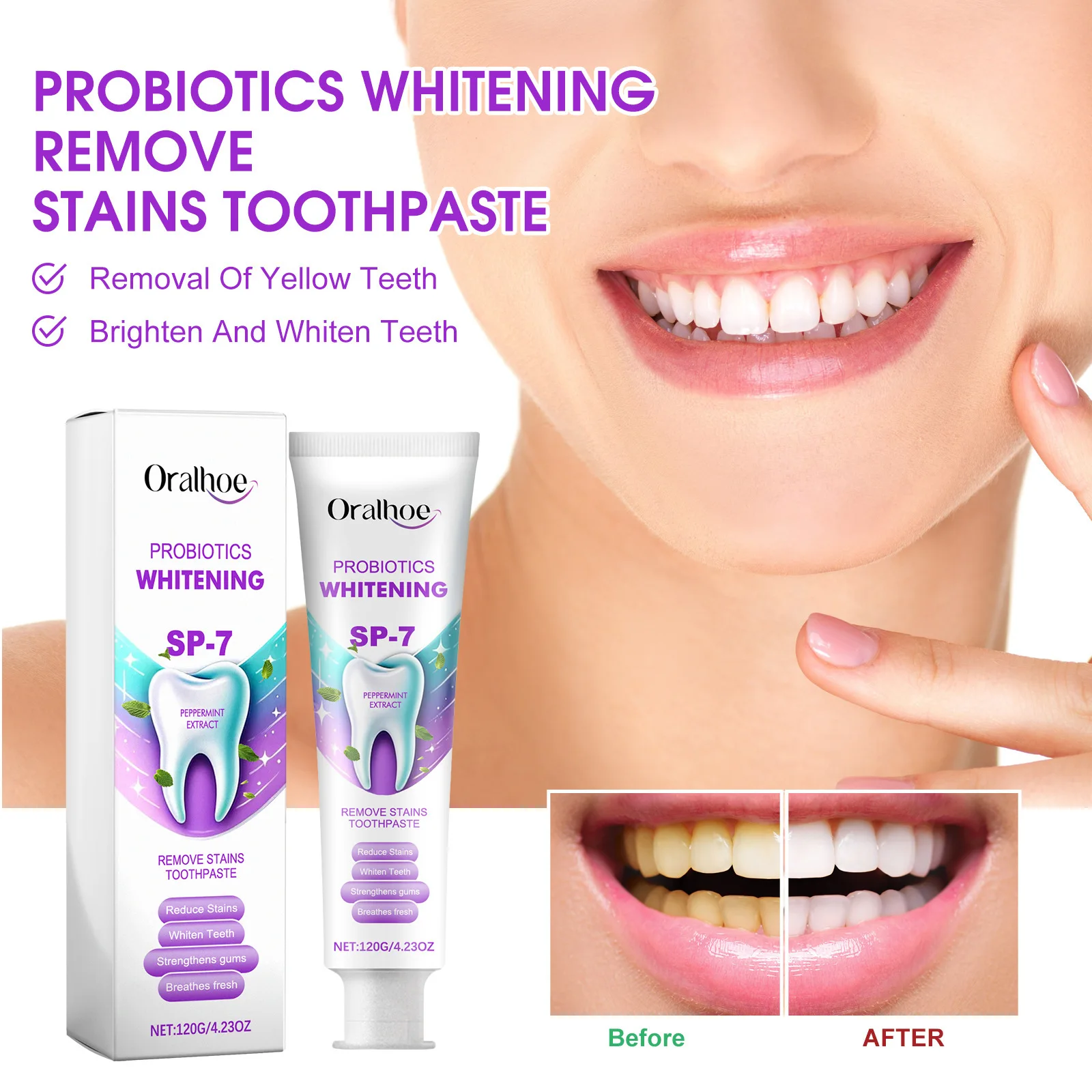 Oralhoe-pasta de dientes probiótica Sp7, 120g, blanqueador de dientes amarillos, alivia la goma hinchada, aliento fresco, reparación de caries, blanquea la pasta de dientes